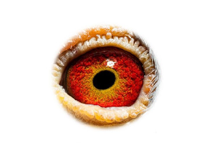 Gr. Son De.KITTEL eye sign